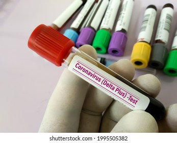 Doctor holding tube of blood test identified with the label Covid-19 Delta Plus Variant. Doctor with a positive blood sample for the new variant detected of the coronavirus strain called Delta plus.