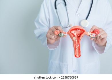 Doctor holding Uterus and Ovaries model. Ovarian and Cervical cancer, Cervix disorder, Endometriosis, Hysterectomy, Uterine fibroids, Reproductive system and Pregnancy concept - Shutterstock ID 2258760989