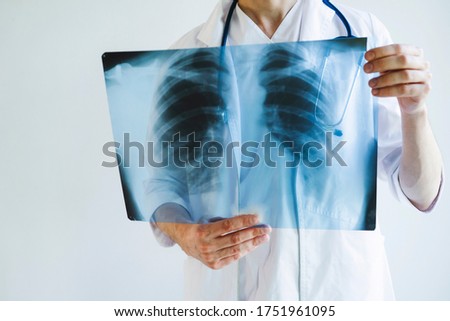 The doctor is holding an X-ray of his lungs. X-rays of a man's lungs. International doctor's day. Doctor on the front line.