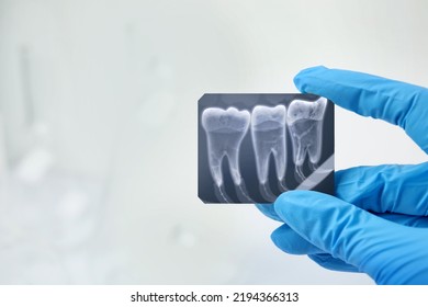 Doctor holding x-ray picture of teeth indoor - Powered by Shutterstock