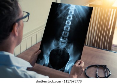 Doctor holding a x-ray of skeleton spine and hips in medical office. 