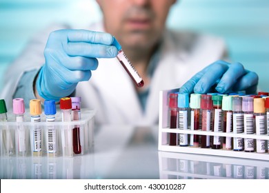 Doctor Holds A Blood Sample Tube In His Hand Testing In The Laboratory / Hands Of A Technician Holding Blood Tube Sample In The Lab