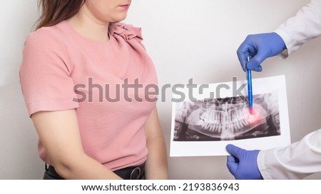 The doctor holds a panoramic X-ray picture of the patient's teeth with a sick semi-urethinal wisdom tooth. Wisdom teeth extraction concept in dentistry, dental abscess