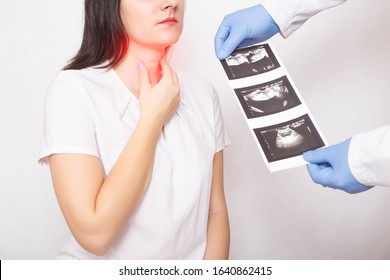 The Doctor Holds The Results Of A Thyroid Ultrasound Examination Of A Girl. Thyroid Diseases, Nodular Goiter, Cancer, Endocrinology