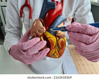 Doctor holds scalpel and concept of cardiac surgery. Treatment of heart diseases of the cortex and blood vessels with surgical operations