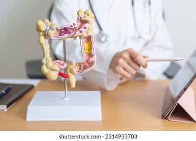 Doctor with human Colon anatomy model and tablet. Colonic disease, Large Intestine, Colorectal cancer, Ulcerative colitis, Diverticulitis, Irritable bowel syndrome and Digestive system  - Shutterstock ID 2314933703