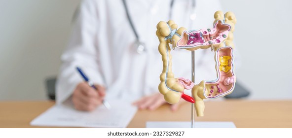 Doctor with human Colon anatomy model. Colonic disease, Large Intestine, Colorectal cancer, Ulcerative colitis, Diverticulitis, Irritable bowel syndrome, Digestive system and Health concept - Shutterstock ID 2327329827