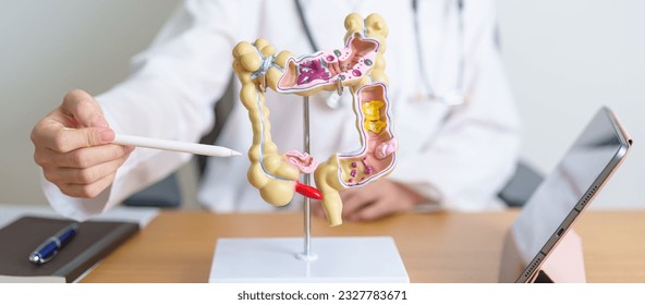 Doctor with human Colon anatomy model and tablet. Colonic disease, Large Intestine, Colorectal cancer, Ulcerative colitis, Diverticulitis, Irritable bowel syndrome and Digestive system  - Shutterstock ID 2327783671