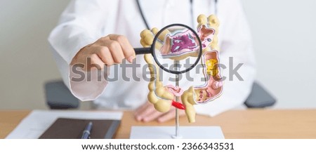 Doctor with human Colon anatomy model and magnifying glass. Colonic disease, Large Intestine, Colorectal cancer, Ulcerative colitis, Diverticulitis, Irritable bowel syndrome and Digestive system 