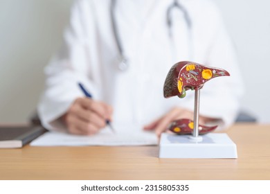 Doctor with human Liver anatomy model. Liver cancer and Tumor, Jaundice, Viral Hepatitis A, B, C, D, E, Cirrhosis, Failure, Enlarged, Hepatic Encephalopathy, Ascites Fluid in Belly and health concept