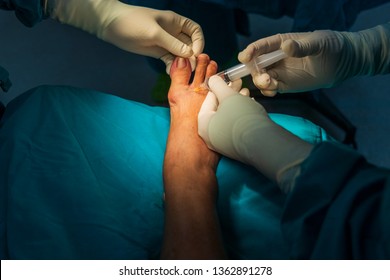 Doctor Injection To Digital Nerve For Peripheral Nerve Block Before Operated On Big Toe In The Case Of Nail Infection. Close Up Photo On Dark Background. Medical Concept. 