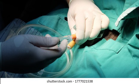 Doctor Inserting Urinary Vladder Catheter Before Surgery Ubder Aseptic Technique.