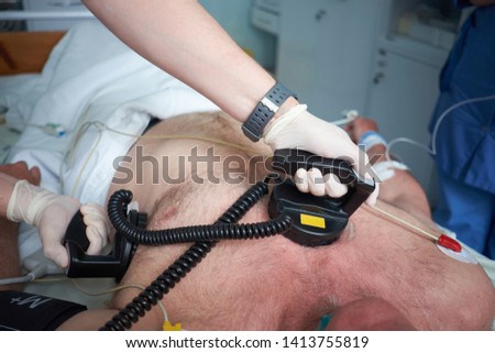 Doctor intensivist performs synchronized cardioversion to patient with atrial febrillation