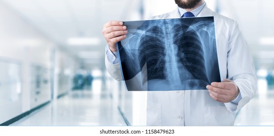 Doctor Looking Chest Xray Stock Photo 1158479623 | Shutterstock