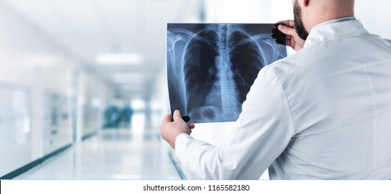 Doctor Looking Chest X-ray