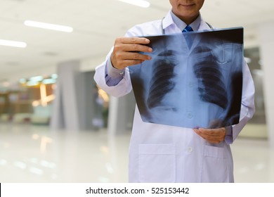 Doctor looking chest x-ray film in hospital.