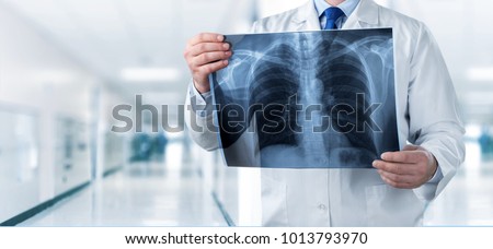 Doctor looking chest x-ray film in hospital