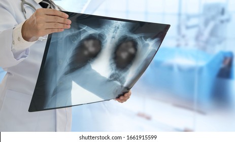 Doctor Looking Pneumonia Patient X-ray Film For Diagnose 
Emphysema,Pneumonia,Inflamed Lung.