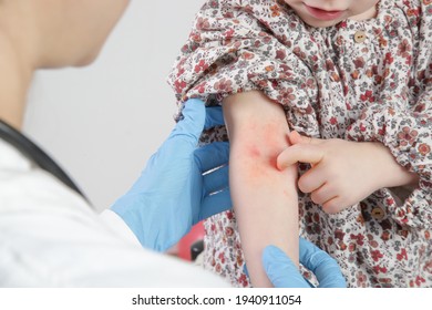 Doctor Looking At Red And Itchy Eczema On Little Girl's Arm. Toddler Girl Suffering From Atopic Dermatitis.