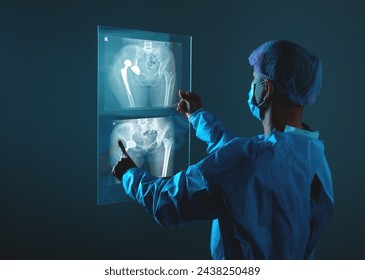 Doctor looking at total hip replacement X-ray film room at the hospital, healthcare concept.