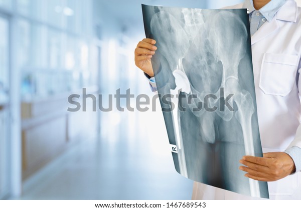 Doctor looking at total hip replacement X-ray\
film with blurred hospital\
background.