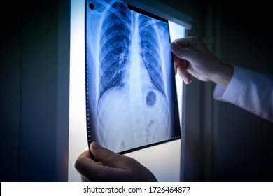 Doctor Looking Xray And Checking Lungs