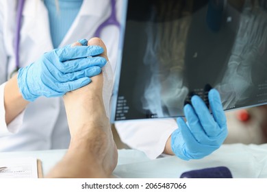 Doctor looking at xray of foot and examining patient leg closeup