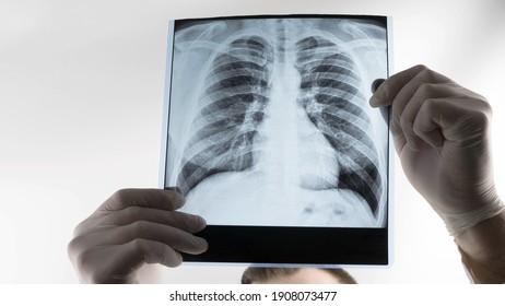 The doctor is looking at the X-ray of the lungs in the clinic, the medical worker is analyzing the disease of pneumonia of the lungs. Respiratory disease. - Shutterstock ID 1908073477