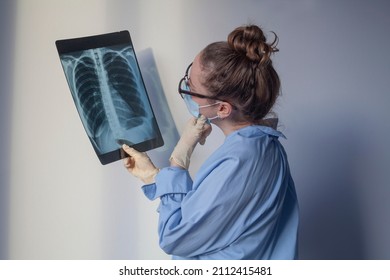 Doctor Is Looking At Xray Of Lungs And Thinking. Female Lung Specialist In Glasses Examining MRI Or Computer Tomography Picture. Covid Diagnostics Concept. Work Of Radiologist.