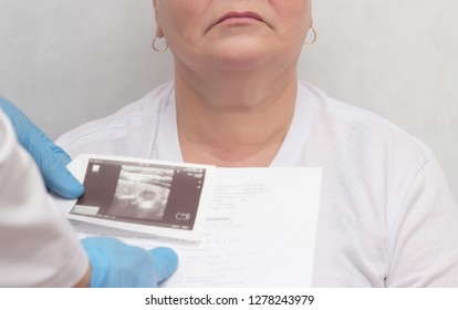 Doctor Looks At Results Of An Ultrasound Scan Of An Adult Woman's Thyroid Gland, Endocrine System Disturbance, Close-up, Inflammation