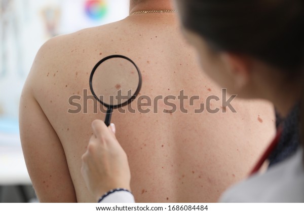 Doctor looks through magnifying glass mole\
patient. Doctor is highly qualified and skilled. Appeal to\
specialist. Effective treatment using drug methods. Skin scrutiny.\
Preservation youth and\
health