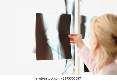 Doctor looks at x-ray film of knee joint before treatment. Image of bone in orthopedic department of hospital concept - Shutterstock ID 2395305587