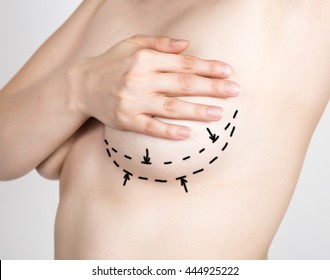 doctor makes dotted line on female body for cellulite correction. cosmetic surgery. lifting and breast augmentation