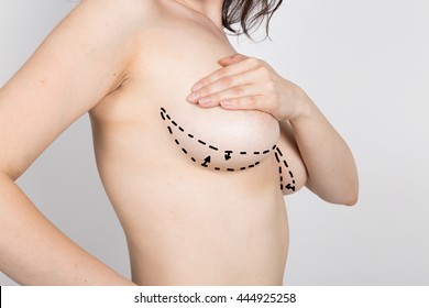 doctor makes dotted line on female body for cellulite correction. cosmetic surgery. lifting and breast augmentation