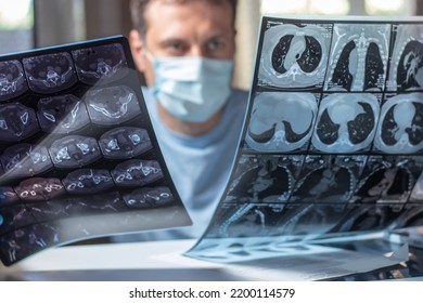 Doctor In Mask Examines And Compares Two MRI Scans.