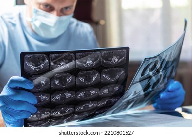 Doctor In Mask Examines And Compares Two MRI Scans.