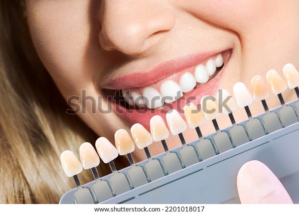 Doctor Matching Patients Teeth Color Palette Stock Photo 2201018017 ...