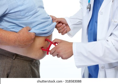 Doctor measuring obese man stomach with body fat calipers.