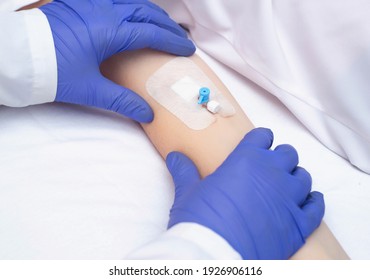 A doctor in medical gloves holds the patient's hand with an intravenous catheter. Concept of human blood diseases, leukemia, biochemistry