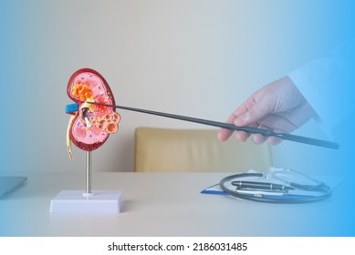 Doctor Nephrologist Pointing Fat Renal Sinus Stock Photo 2186031485 ...