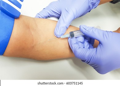 Doctor Or Nurse Hands In Medical Blue Gloves Using Needle Syringe Drawing Blood Sample From Patient Arm In Hospital. Scientist Get Blood Draw For Hemoculture Testing As Specimen In Research Laboratory