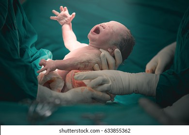 Ärztin und Krankenschwester ziehen ein Neugeborenes aus dem Bauch der Mutter - Concept Genesis
