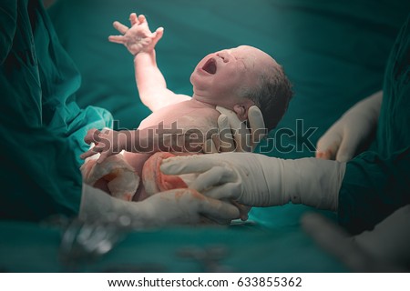 Doctor and nurse are pulling a new born baby from mom's abdomen - Concept Genesis