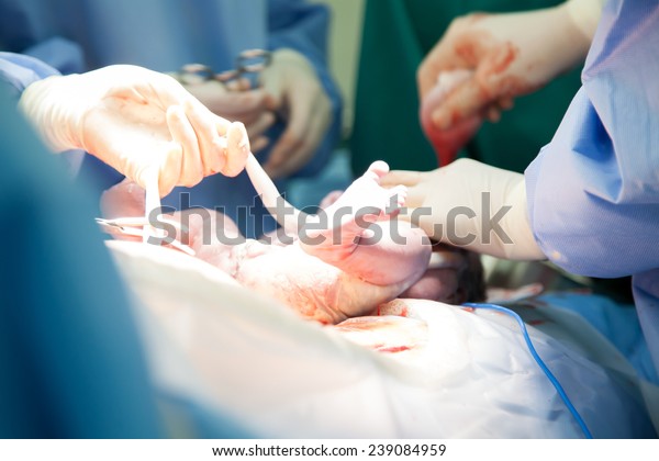Doctor and nurse are  pulling a new born baby
from mom's abdomen