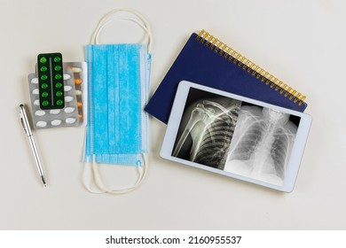 Doctor Office Desk Table With Using Digital Tablet Computed Radiography Of Left Shoulder Joint, Antero-posterior