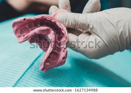 Doctor orthodontist in gloves holds a fingerprint for denture purple