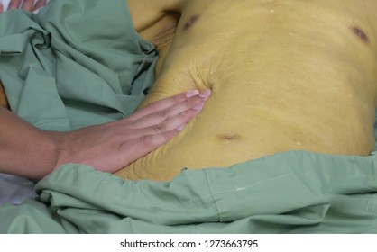 Doctor Palpating The Abdomen Of Jaundice Patient .