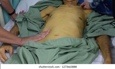 Doctor Palpating The Abdomen Of Jaundice Patient .