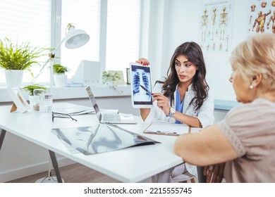 Doctor and patient discussing scan results in hospital. Doctor checking examining chest x-ray film of patient at ward hospital. Doctor examining at lungs radiograph x-ray film of patient.  - Powered by Shutterstock