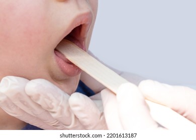 Doctor Pediatrician Checking Boy Kid Throat With Wooden Spatula.spatula On Tongue,wide Open Mouth Crying Upset Sad Child.medical Assistance Hands In White Surgical Gloves.sore Throat Redness Angina